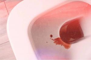 Menstruationsblut in Toilette